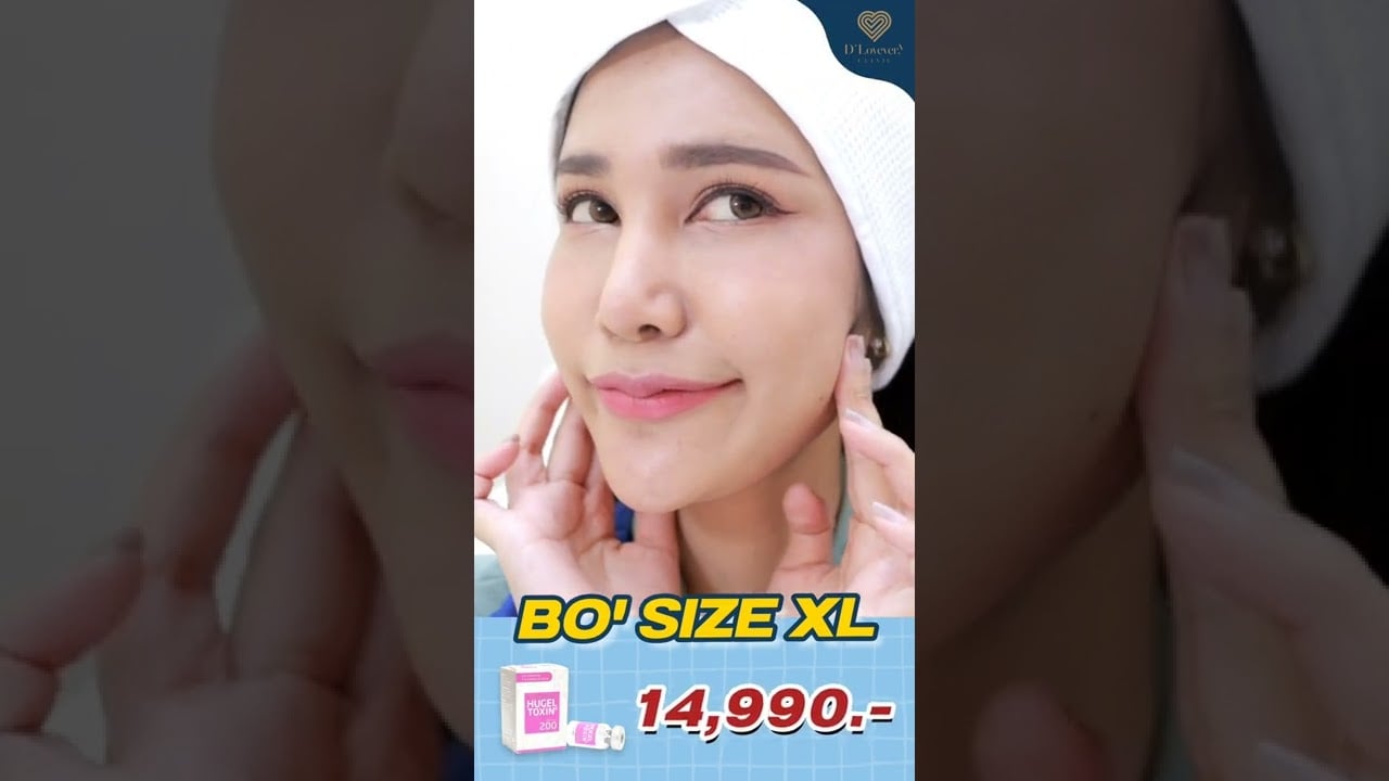 Size XL กับโปรฯโบท็อกซ์แฟต โบได้ 4 จุด กราม ลิฟกรอบหน้า ปีกจมูก รัดแกนจมูก แฟตแก้มเหนียงรวม 6 เข็ม