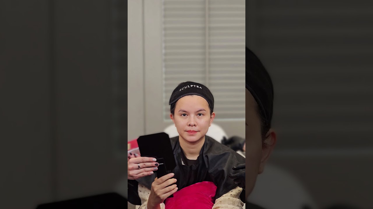 ฉีด Sculptra ดีไหม เจ็บไหม รีวิวสั้นๆ แต่ได้ใจความ หมอต้าร์ D' Lovevery clinic