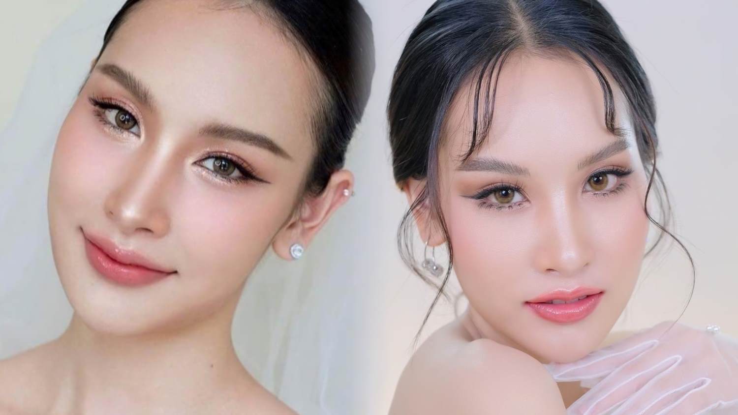 รีวิวหลังเติมฟิลเลอร์ขมับตอบ หมอต้าร์ D' Lovevery clinic