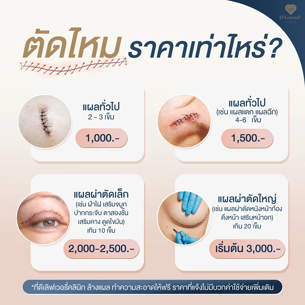 ราคาตัดไหม อัพเดท 2025 คลินิกตัดไหม ใกล้ฉัน