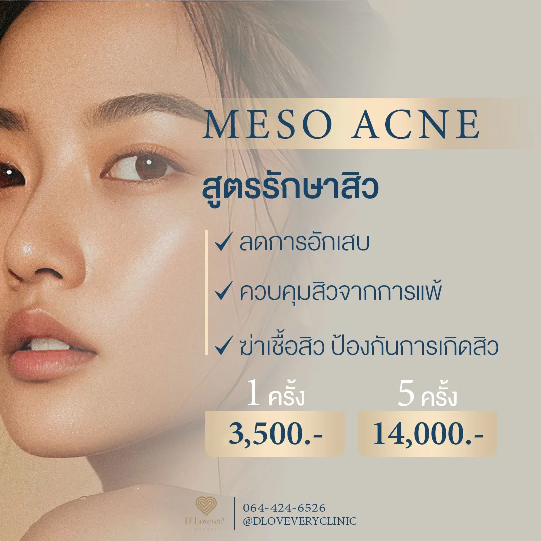 meso acne เมโส รักษาสิว ราคา Dlovevery clinic