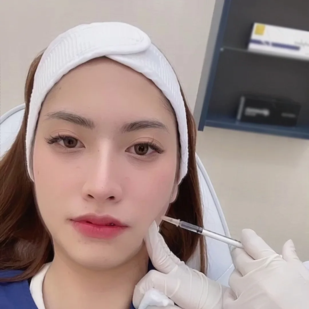 botox กราม รีวิว
