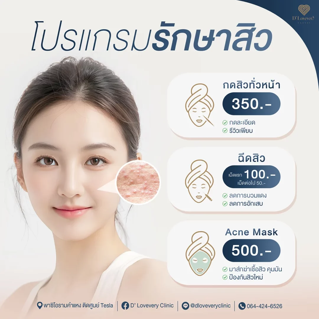 กดสิว ราคา