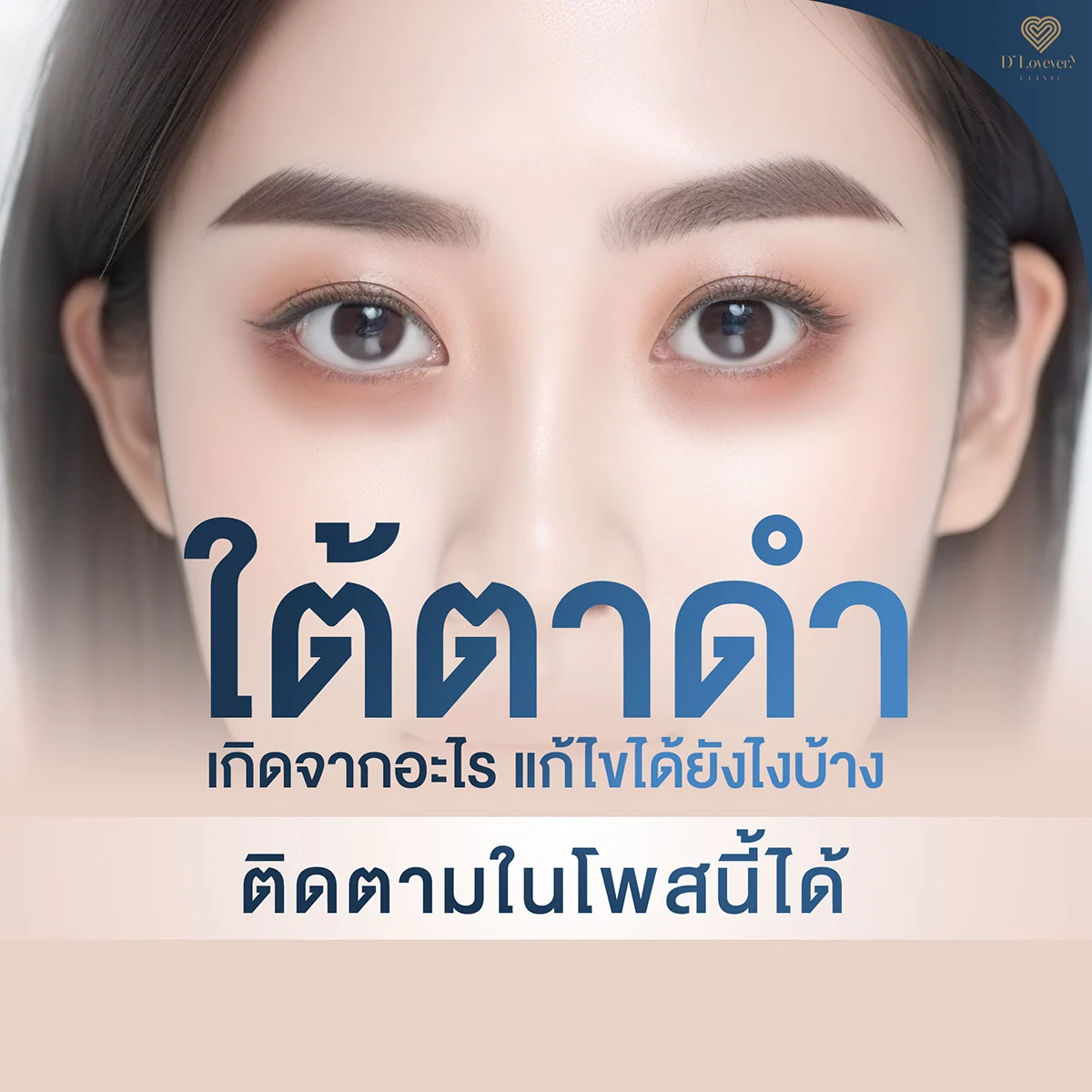 ใต้ตาดำ เกิดจากอะไร แก้ไขได้ยังไงบ้าง ติดตามในโพสนี้ได้