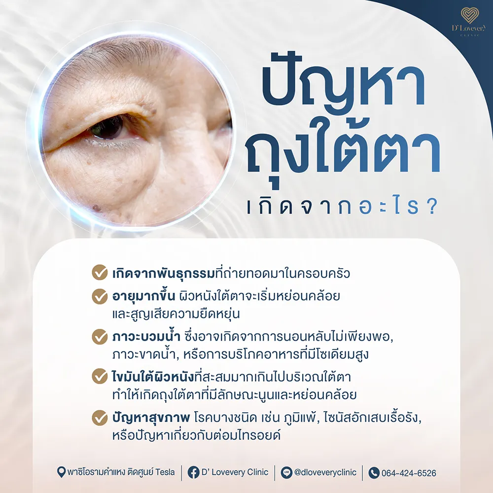 ถุงใต้ตา แก้ไขยังไง