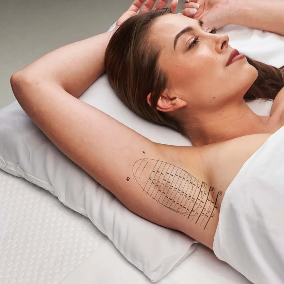 Is Botox effective in reducing sweating? -2
