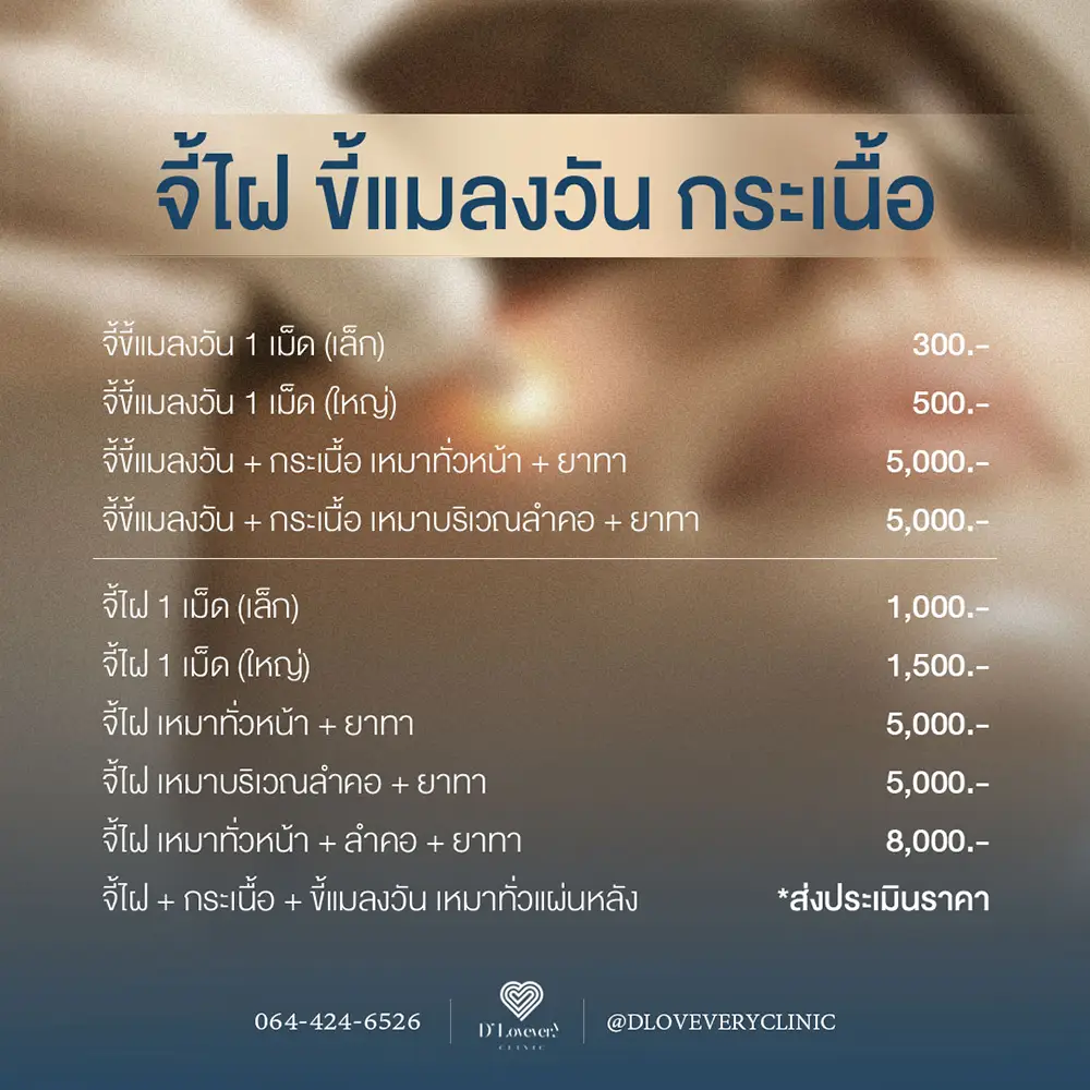 จี้กระเนื้อ เหมาคอ ราคา