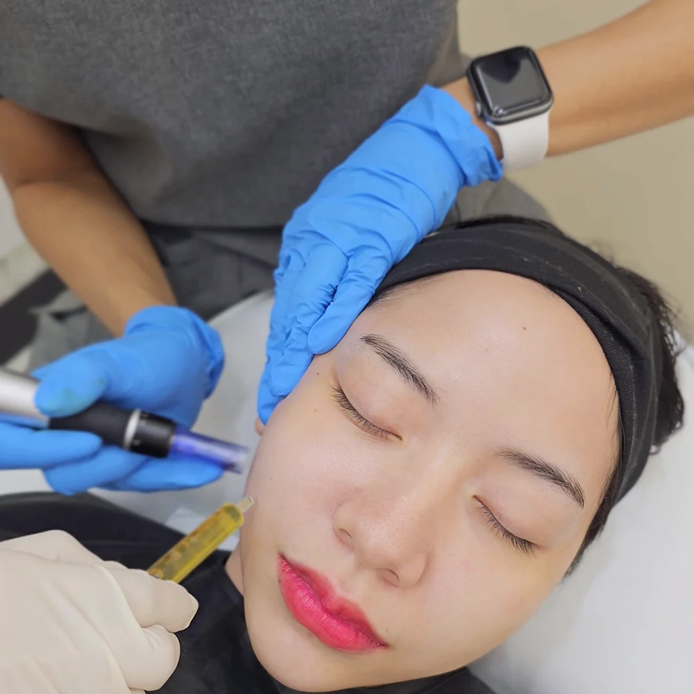 บรรยากาศ น้องเนย รีวิวฉีด restylane vital light Growth Factor dlovevery clinic 3