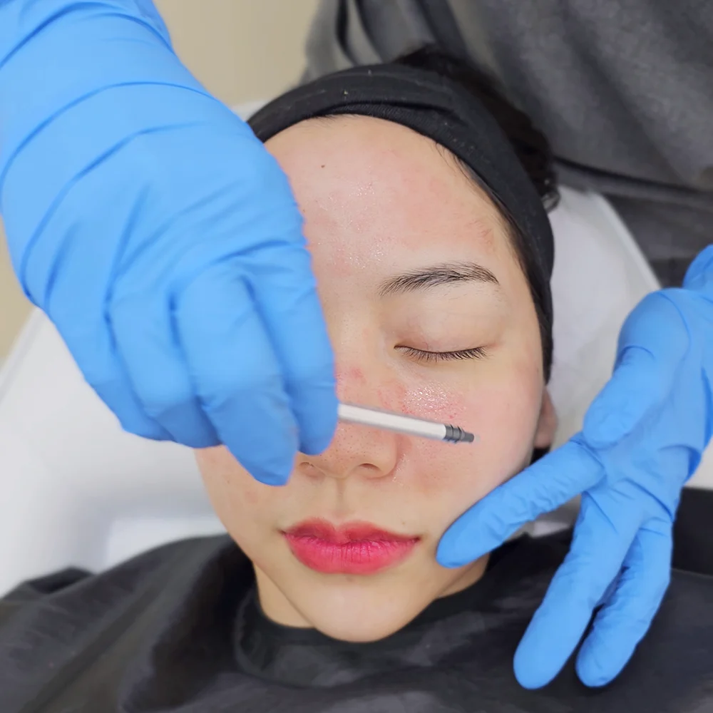บรรยากาศ น้องเนย รีวิวฉีด restylane vital light Growth Factor dlovevery clinic 4