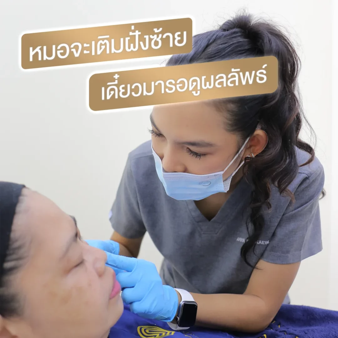 รีวิวการเติมฟิลเลอร์ใต้ตา ที่มาครั้งแรก ก็ประทับใจเลย