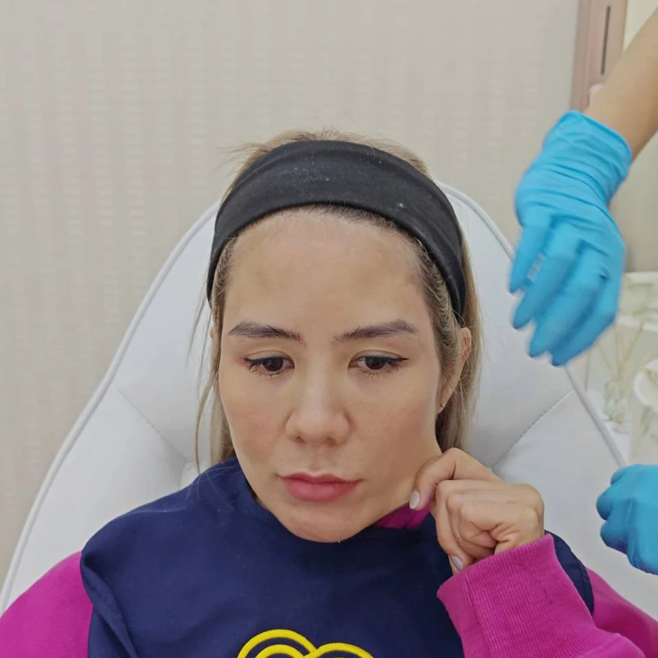 หมอต้าร์ ฉีดฟิลเลอร์ขมับ แก้มตอบ เช็คปัญหาผิวหย่อนคล้อย dlovevery clinic