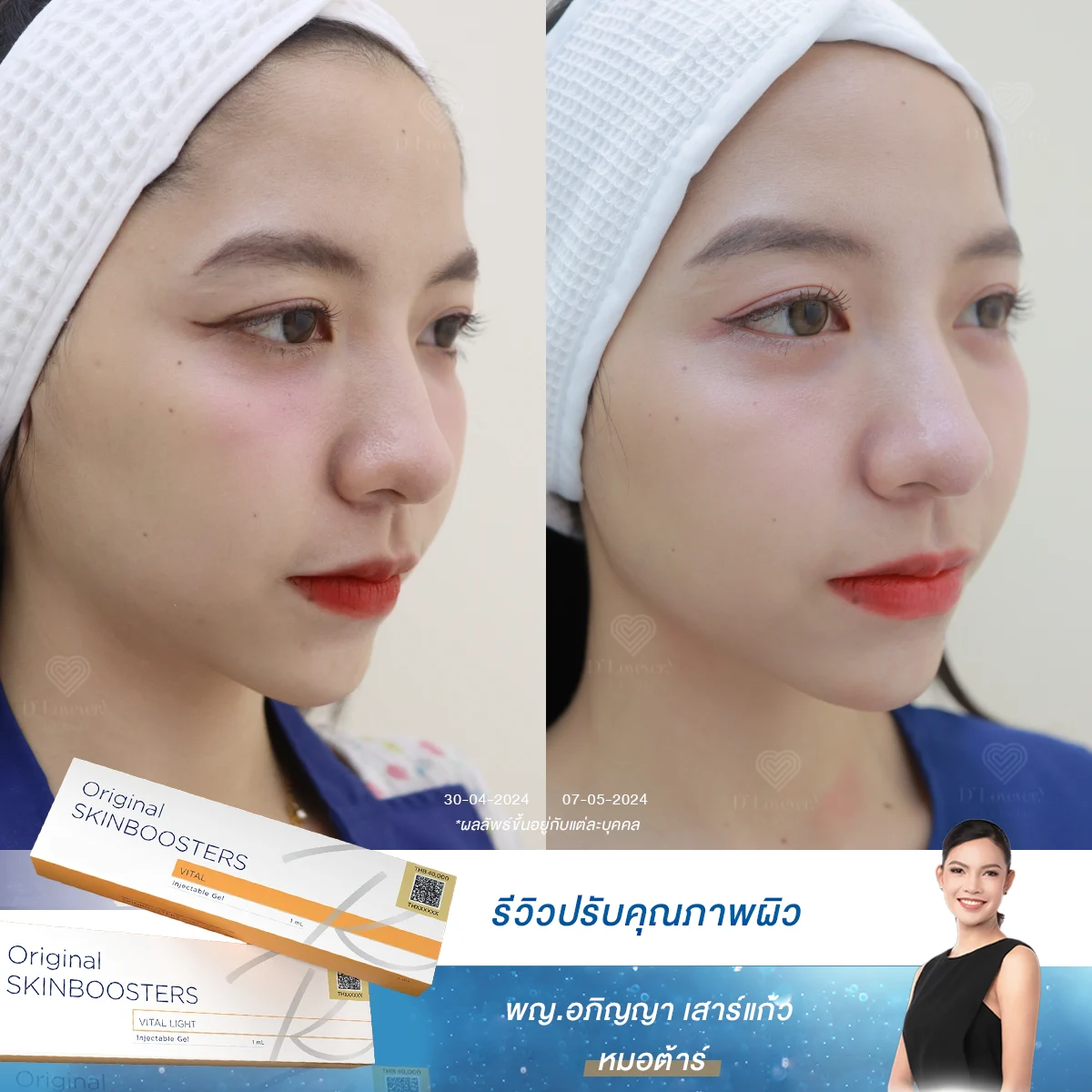 เคล็ด (ไม่) ลับผิวออร่า! คุณผู้หญิงก็มีผิวสวยใสได้ แค่เติม Skinbooster และ Growth Factor กับหมอต้าร์