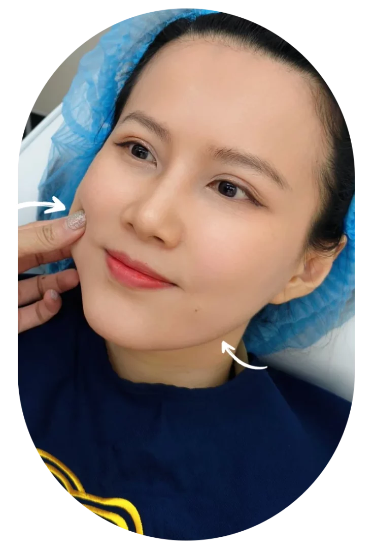 ที่อื่นบอกไม่จำกัดช็อต แต่ไม่เห็นผล ที่นี่บอกว่า "ไม่เน้นช็อต เน้นผลลัพธ์"