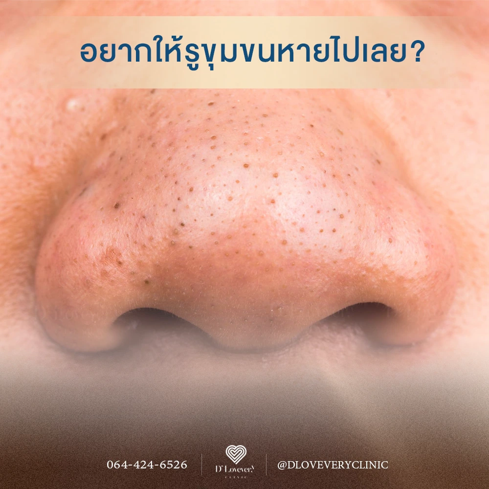 อยากให้รูขุมขนจมูก หน้าแก้ม หายไปเลยได้ไหม