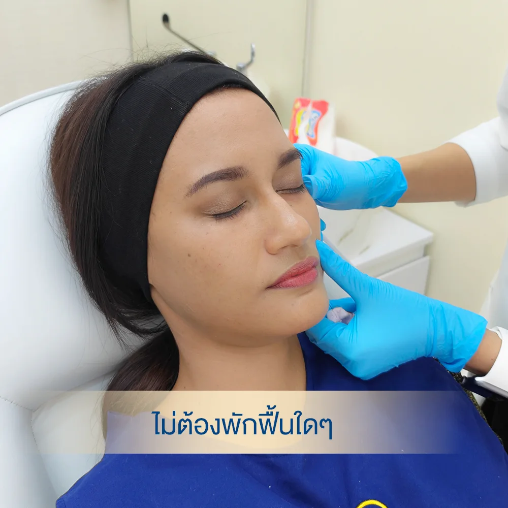 ข้อดีของการฉีดฟิลเลอร์ใต้ตา คือเห็นผลทันที ไม่มีพักฟื้น