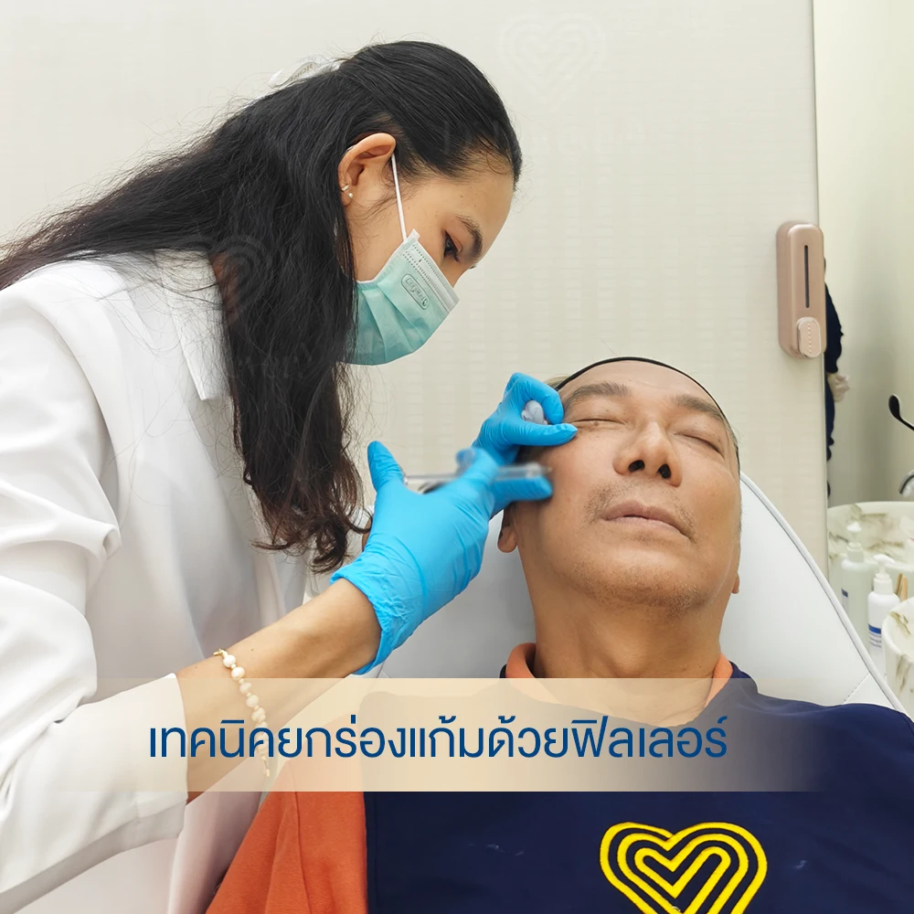 ดูแลจบที่เดียว! ฟิลเลอร์ร่องแก้ม เติมเต็ม กระเนื้อจุดเล็ก ๆ ไม่รบกวนใจ