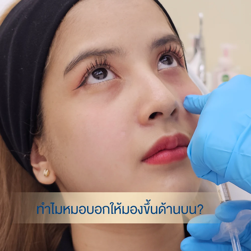 ภาพเคสรีวิว 66 ฟิลเลอร์ใต้ตา หมอต้าร์ ดูแลทุกเคส