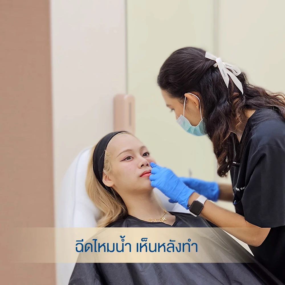 รีวิวฉีดไหมน้ำใต้ตา ไหมน้ำ Ultracol เห็นทันทีหลังทำ