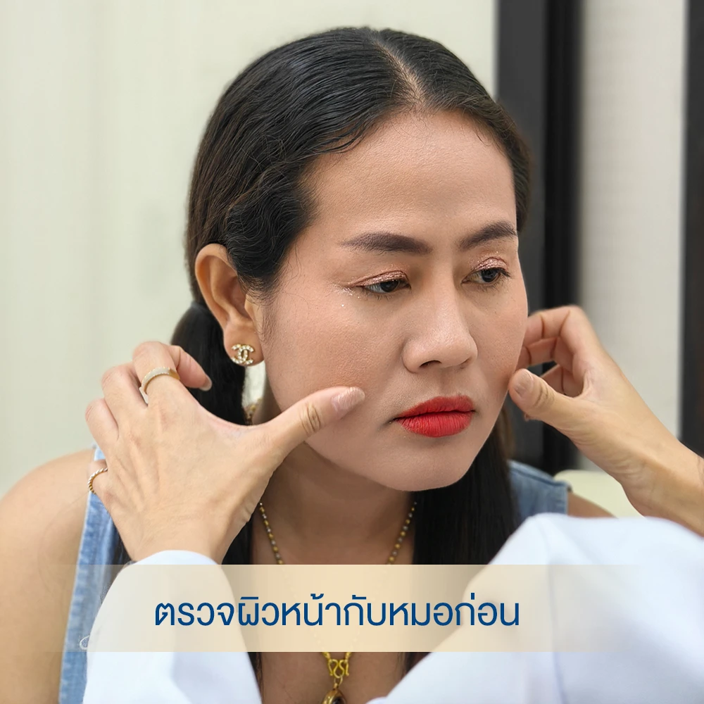 รีวิวฟิลเลอร์ใต้ตา อายุ 50 ใต้ตาคล้ำลึก dlovevery clinic ตรวจผิวหน้า
