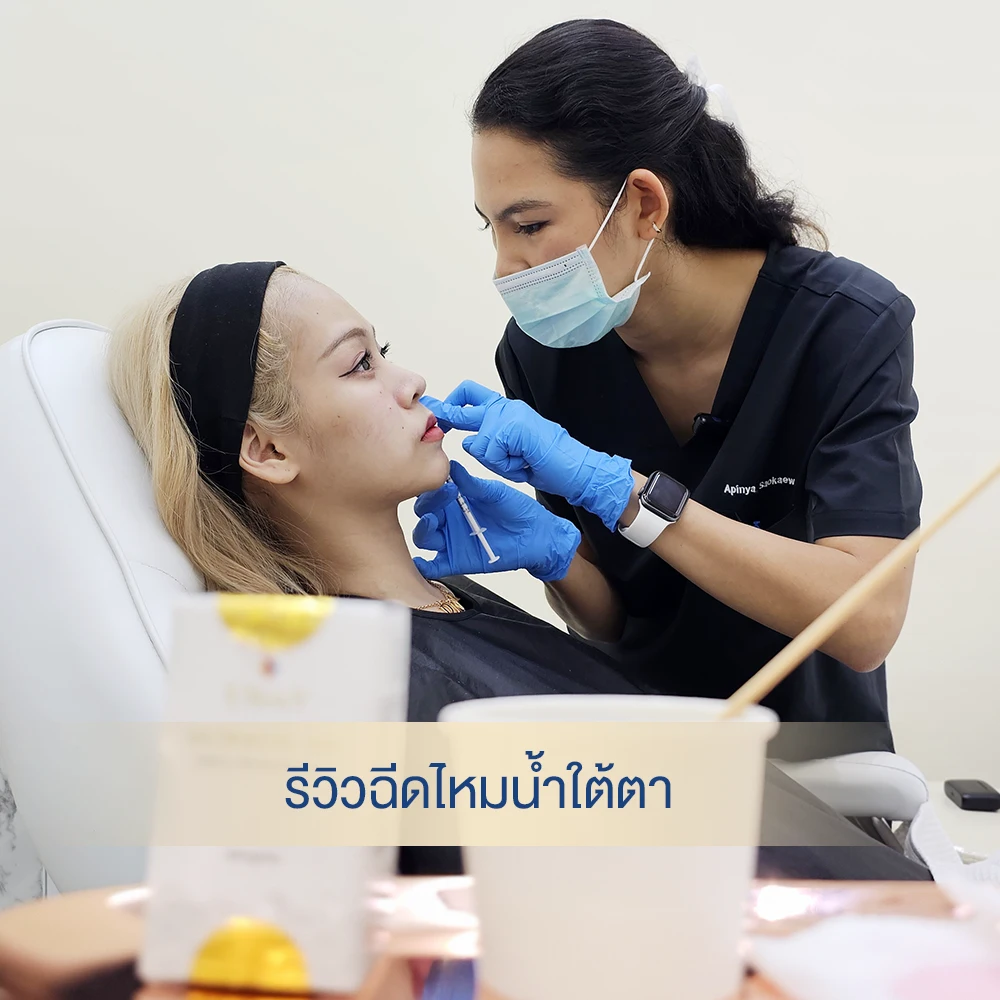 รีวิวฉีดไหมน้ำใต้ตา ไหมน้ำ Ultracol
