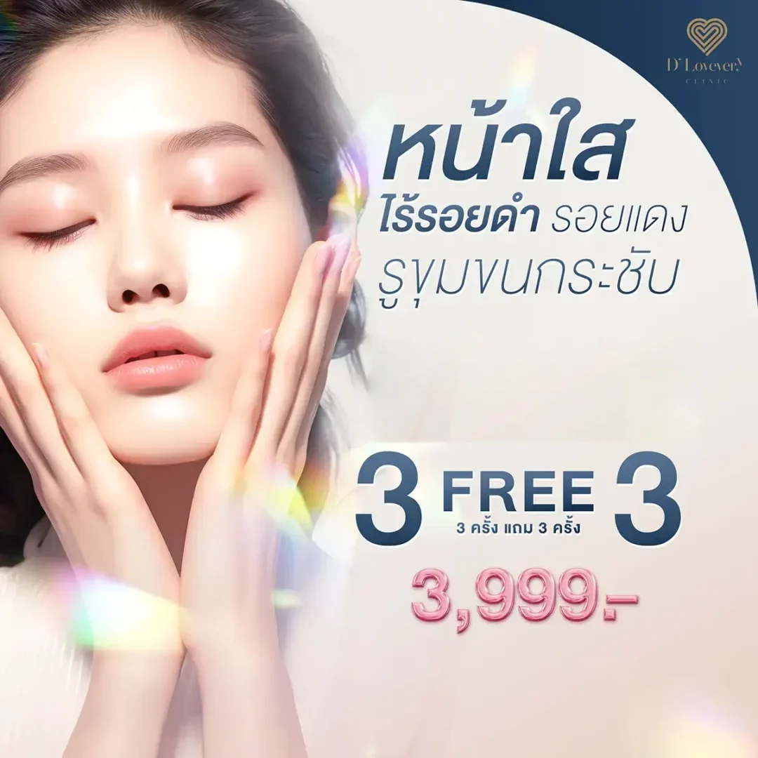 รักษารอยสิว-ราคาสุดคุ้ม-โปรโมชั่น-3-แถม-3