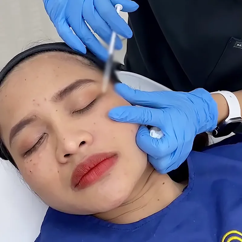 แค่ใต้ตาใส หน้าก็สดชื่นขึ้นเยอะแล้วไม่ใช่เหรอ