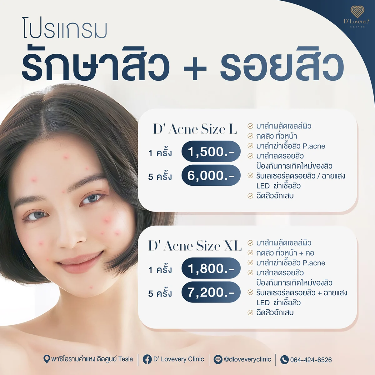 โปรแกรมรักษาสิว-รอยสิว มี ipl หรือเลือกเป็น ฉายแสง LED ดีเลิฟเวอรี่คลินิก