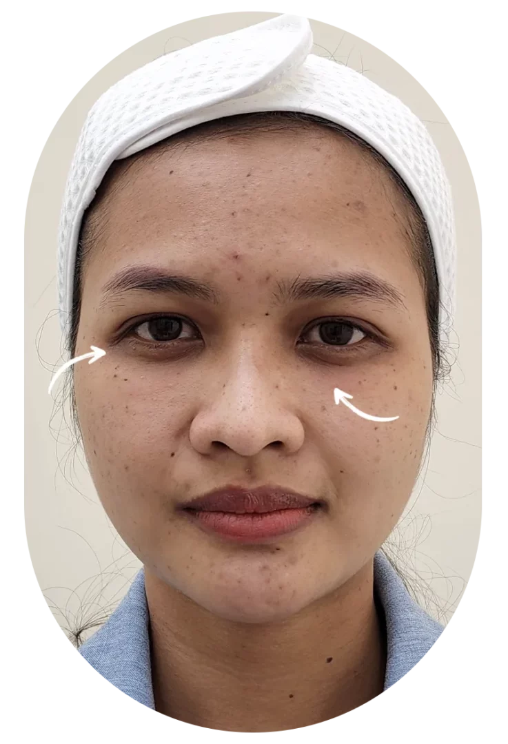 แค่ตื่นมามองกระจกก็พอแล้ว ใต้ตานี่มันต้องหมองขนาดนี้เลยเหรอ?