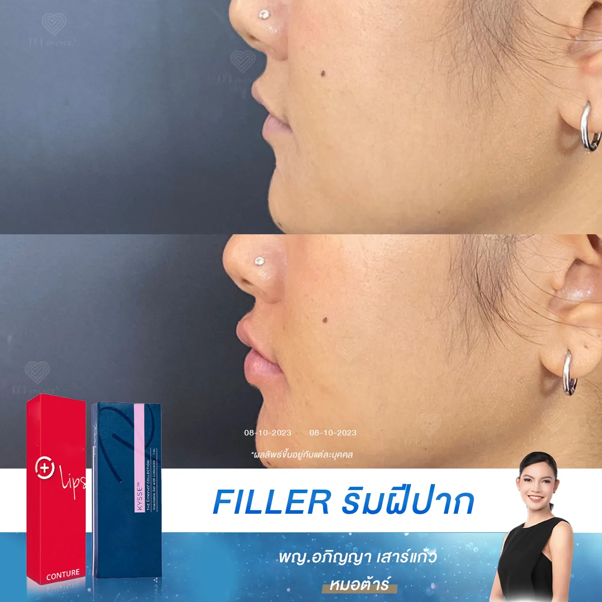 เคยมั้ย อยากทาลิปสีไหนก็สวย ไม่ติดร่องเสียที