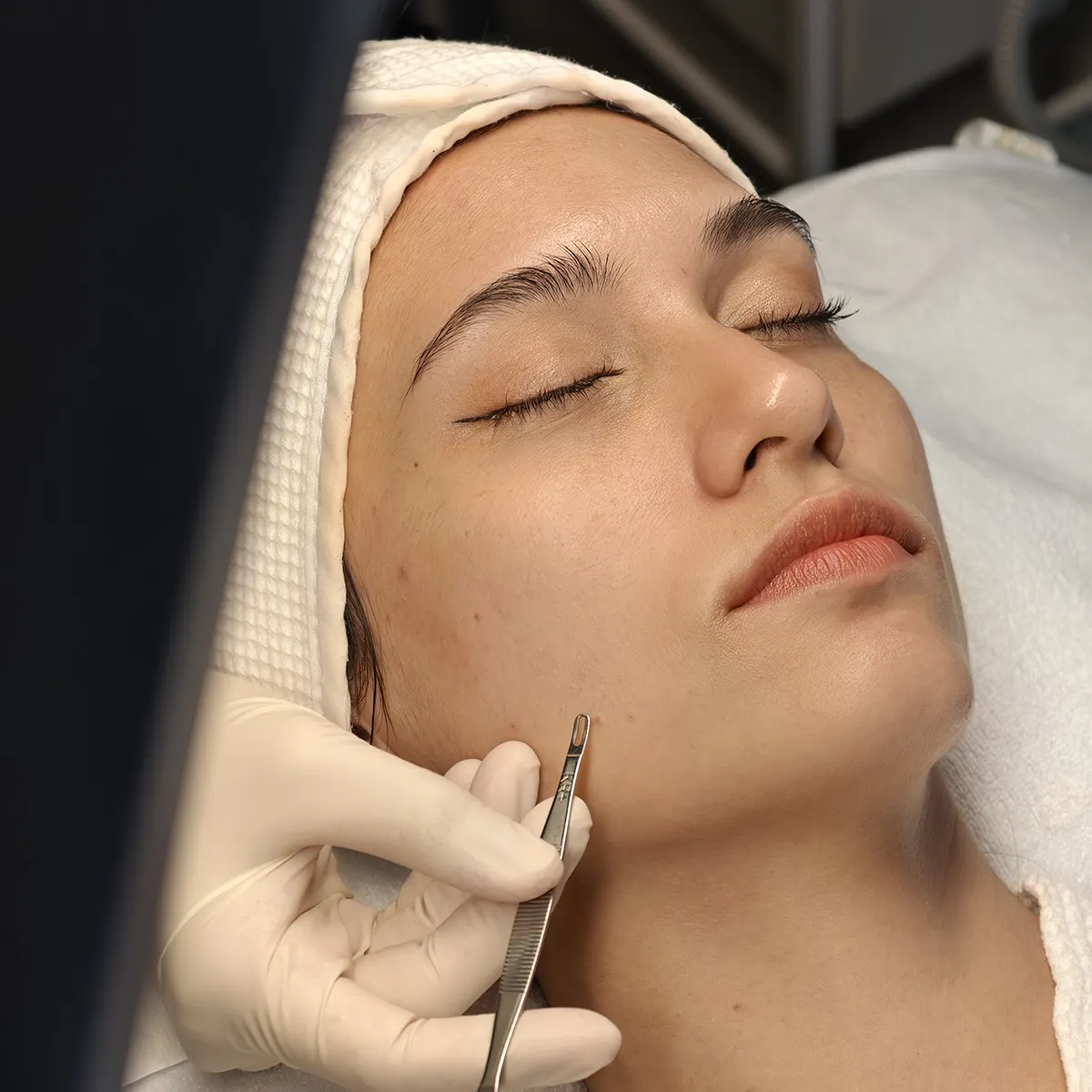 งานผิวสวยไม่ต้องพักฟื้น ใครยังไม่กล้าฉีดต้องอ่านรีวิวนี้