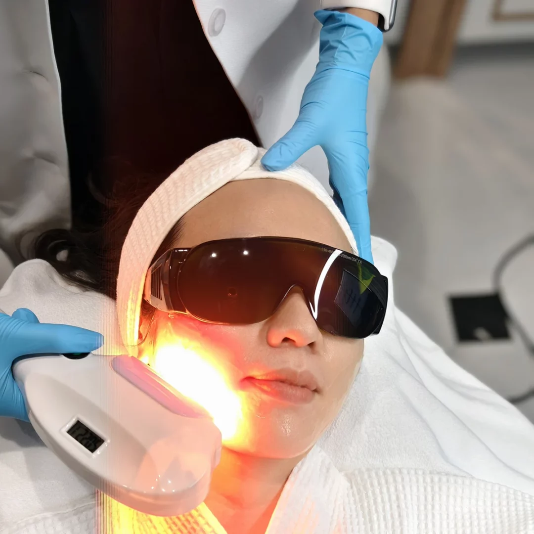 เคสรีวิวจริง! ทำ Pico Laser กับ IPL ผลลัพธ์ดีกว่าที่คิด