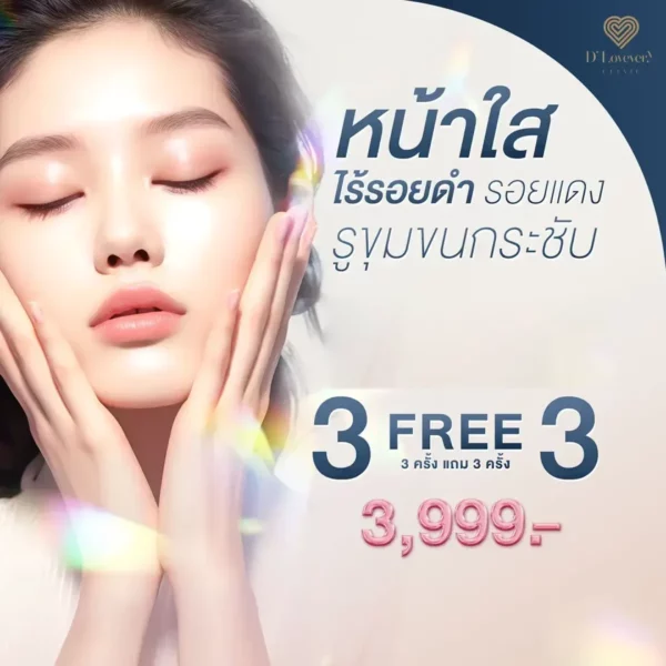 รักษารอยสิว-ราคาสุดคุ้ม-โปรโมชั่น-3-แถม-3