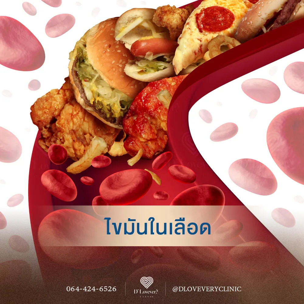 ไขมันในเลือดสูง ทำยังไง ปากกาลดน้ำหนักช่วยได้ไหม
