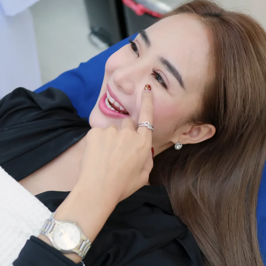 โปรปัง! ฟิลเลอร์ปากเกาหลี 8,999.- ที่ D'Lovevery Clinic Paseo รามคำแหง ใกล้แค่เอื้อม
