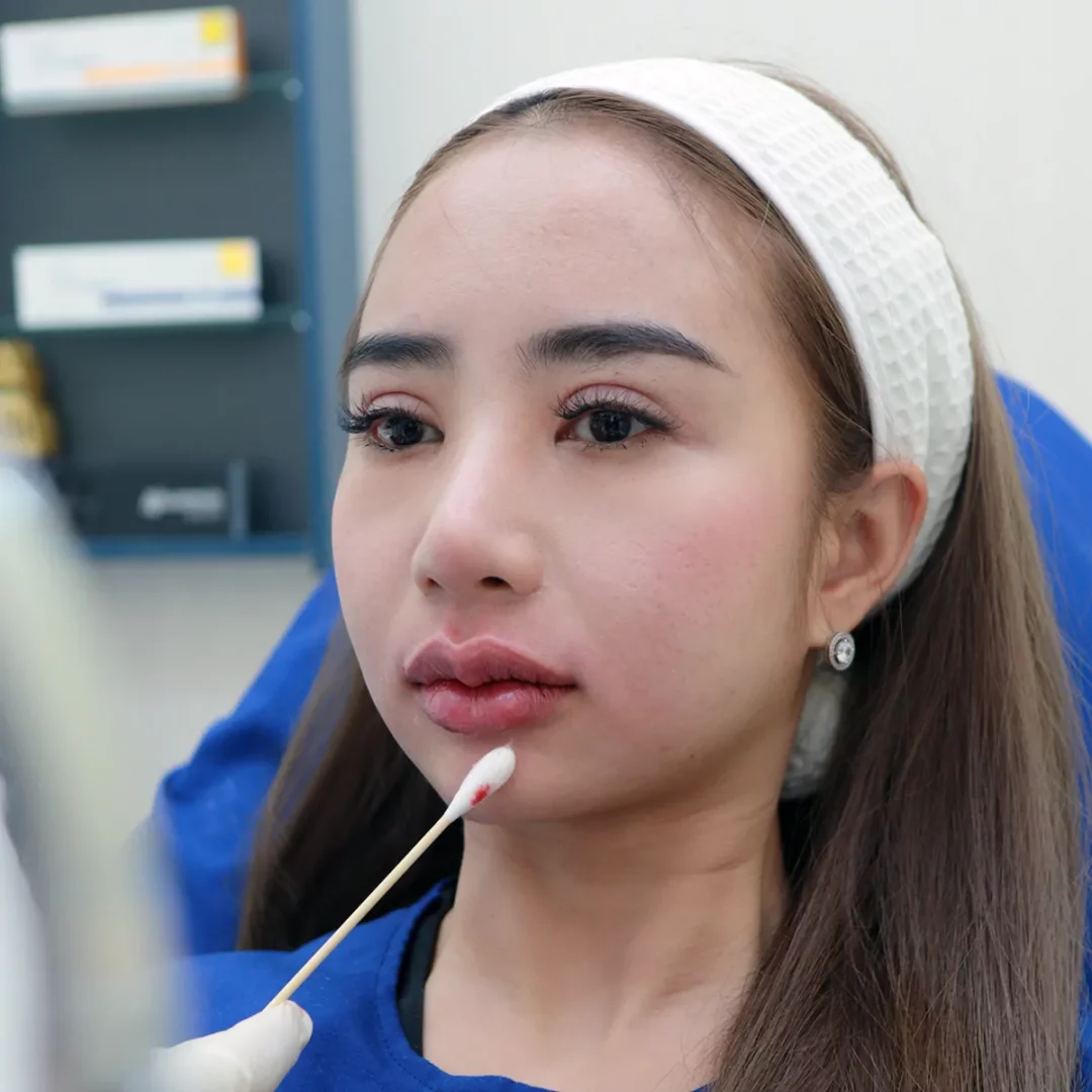 หนุ่มสาวชาวสัมมากร-สุขาภิบาล 3 อยากปากสวย มาที่ D'Lovevery Paseo รามคำแหงสิคะ! ราคาดีมาก