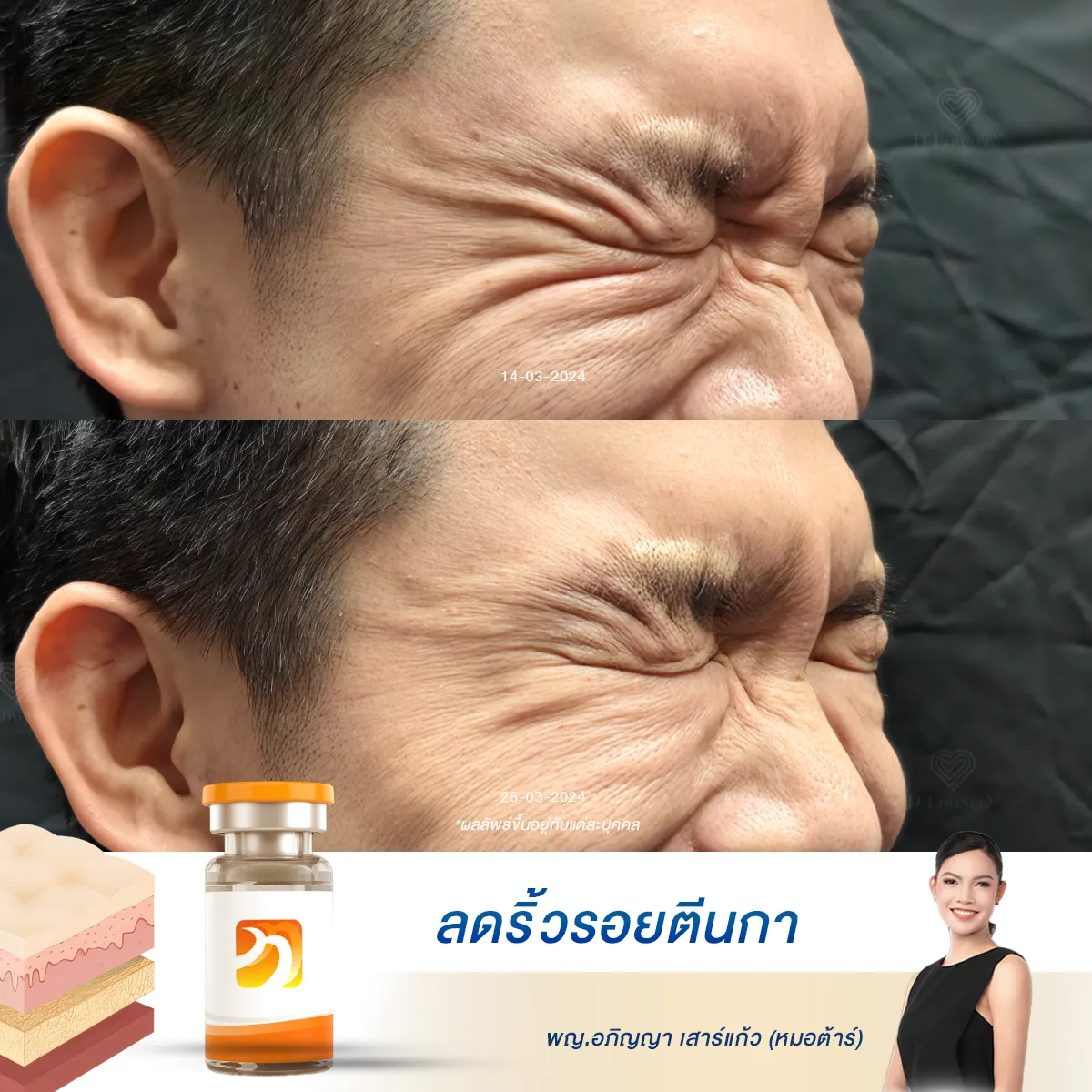 คุณกำลังทำงานเครียดจนหน้าดูแก่ขึ้นหรือเปล่า บทความนี้มีคำตอบ