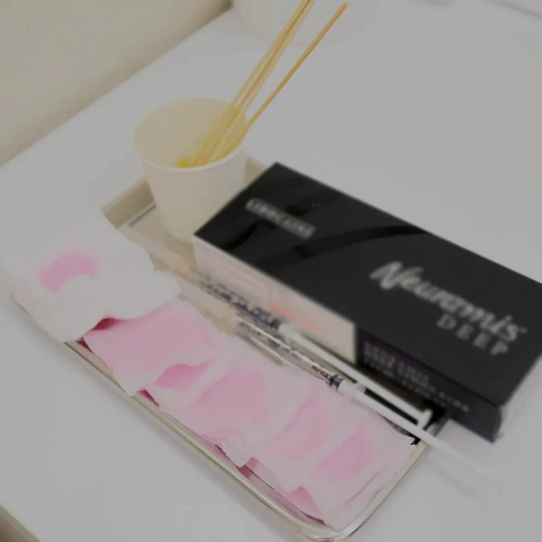 ฟิลเลอร์กล่องดำ Neuramis ราคา 8999