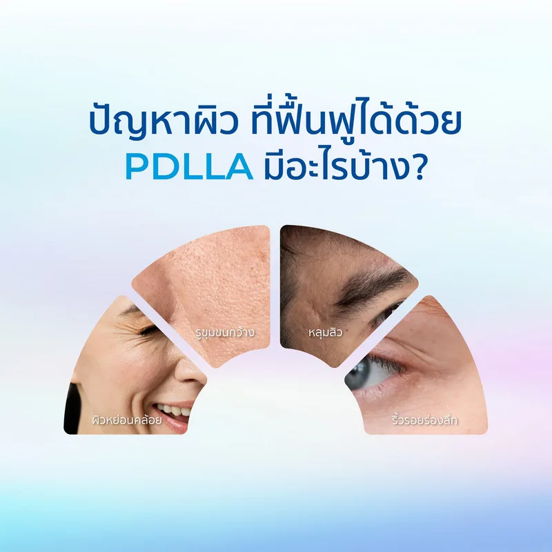 Juvelook และ Lenisna โดย D' LOVEVERY CLINIC พร้อมข้อมูลติดต่อ 2 สาขา: พาซิโอ รามคำแหง 064-424-6526 และ CDC 095-236-4546
