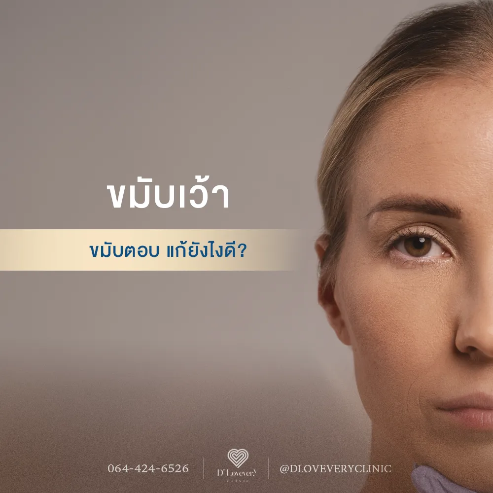 ขมับเว้ามาก ทำยังไงดี? รวมวิธีแก้ไข-เติมเต็มขมับโดยผู้เชี่ยวชาญ
