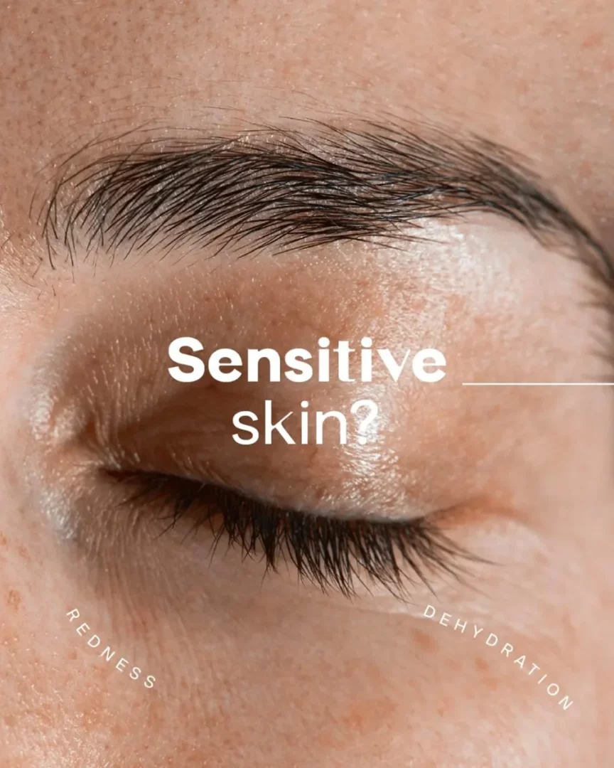 Plinest-sensitive skin