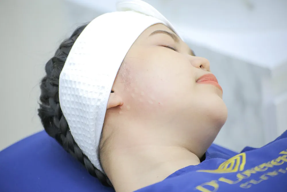 หน้าเรียวทันใจใกล้บ้านคุณ! ดีเลิฟเวอรี่คลินิก สัมมากร จัดให้