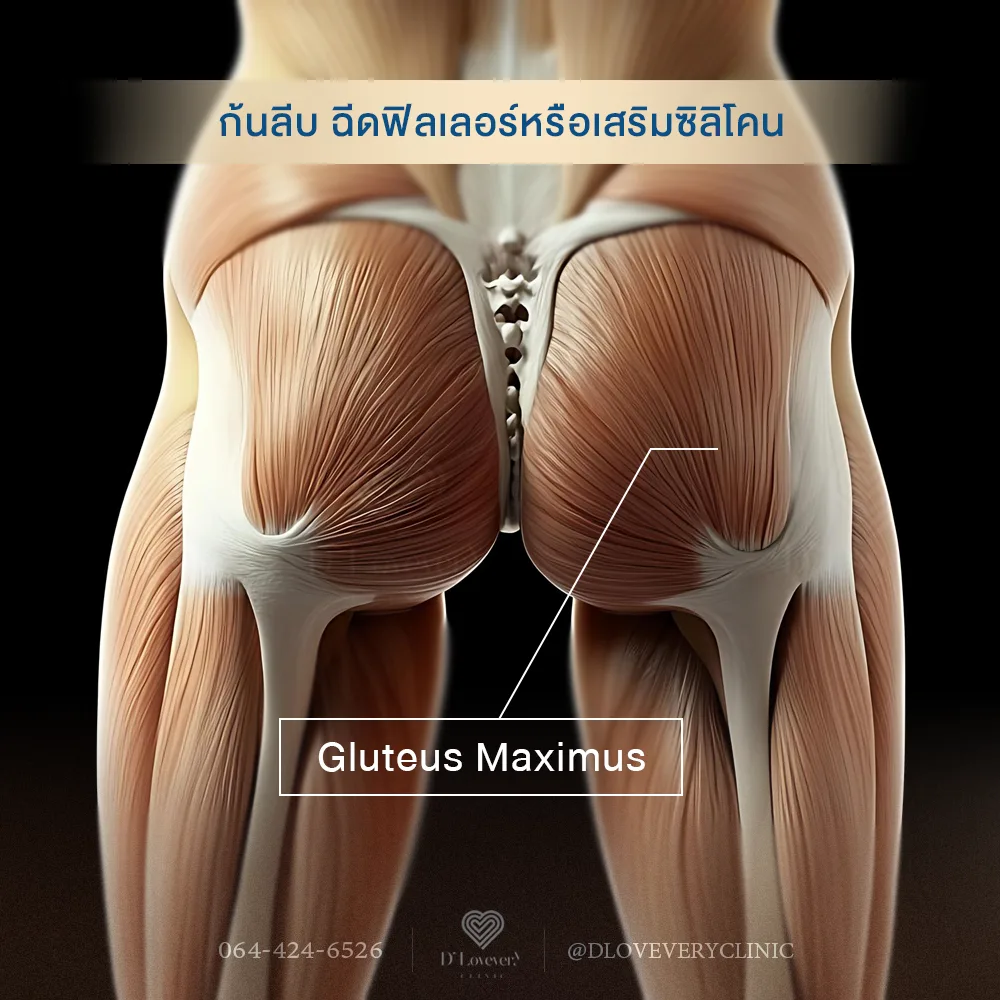 กล้ามเนื้อ Gluteus Maximus ที่ทำให้ก้นดูแบน ไม่กลมมน ซึ่งเป็นคนละตำแหน่งกับสะโพกด้านข้าง (Hips)