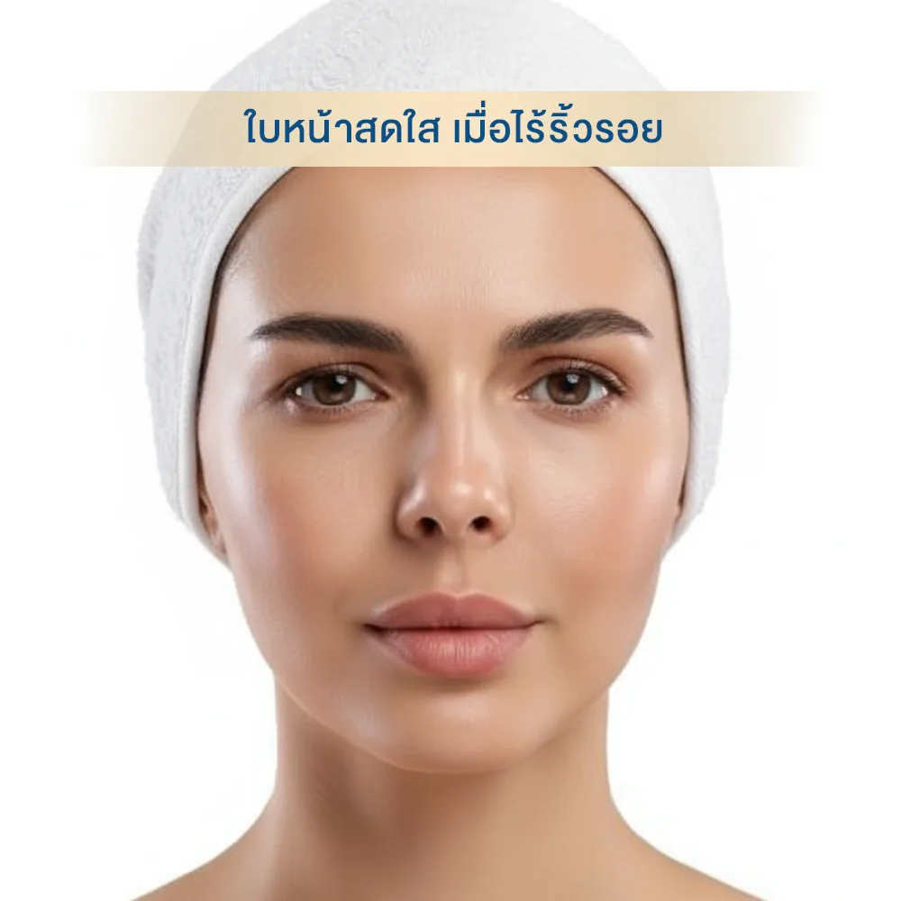 ฉีดโบลดริ้วรอยระหว่างคิ้ว คืออะไร กี่วันเห็นผล อันตรายไหม หน้าดูสดใส สดชื่น เมื่อไร้ริ้วรอย