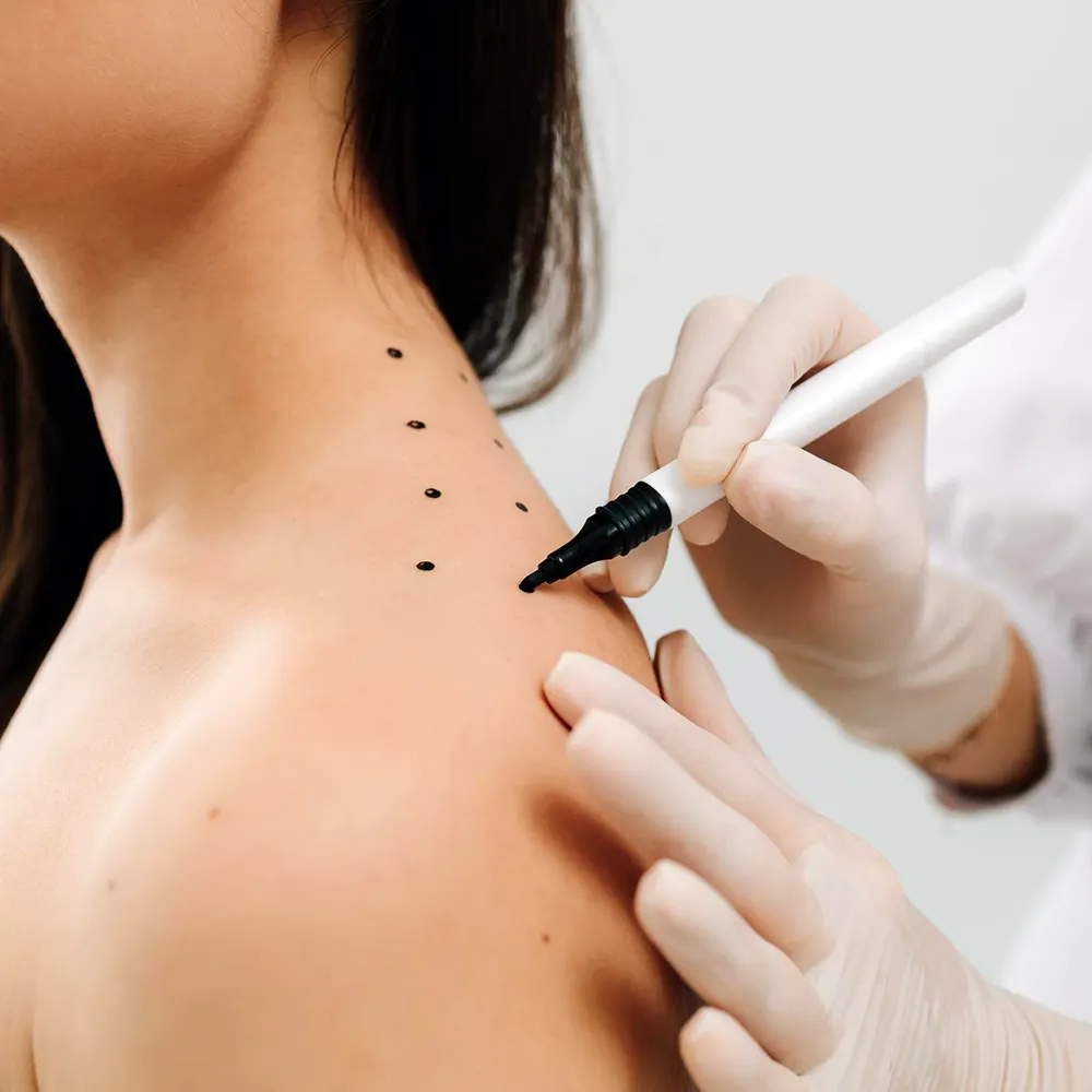 ฉีดโบท็อกซ์ แก้ปวดไมเกรน ทำได้จริงไหม ฉีดตรงไหน ราคาเท่าไหร่ คำถามที่พบบ่อย