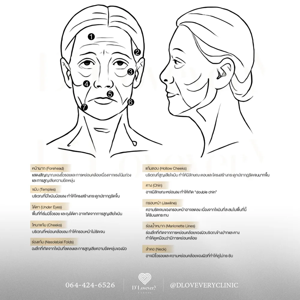 หน้าทรุดคืออะไร ต้องแก้ไขด้วยวิธีไหน ฉีดฟิลเลอร์จุดไหนดี ใช้กี่ cc