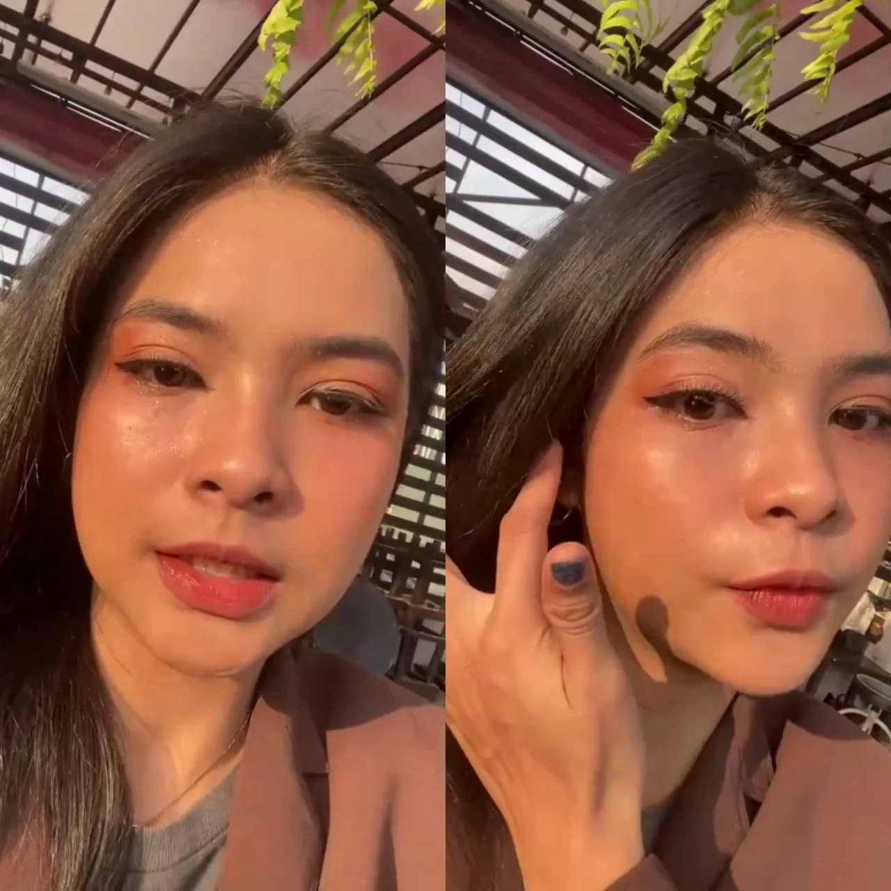 ไม่ต้องง้อเมคอัพ! ฟิลเลอร์ใต้ตาที่ D' Lovevery Clinic ช่วยให้คุณสวยใสแบบธรรมชาติ!