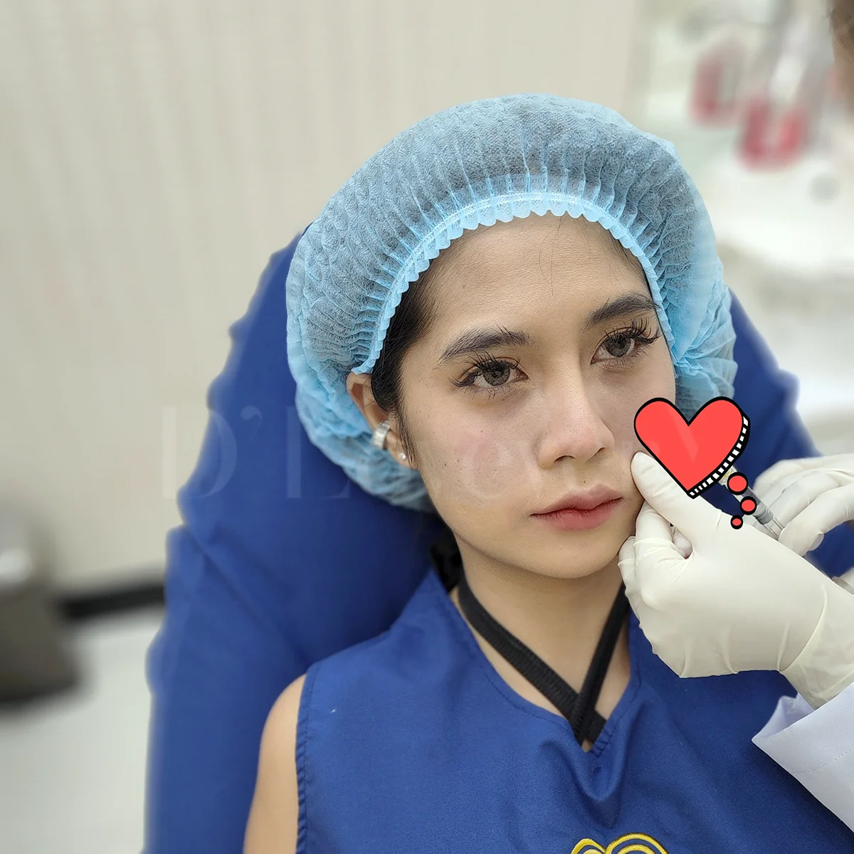 ใต้ตาคล้ำทำไงดี? ฟิลเลอร์ใต้ตาช่วยได้! (รีวิวละเอียด)