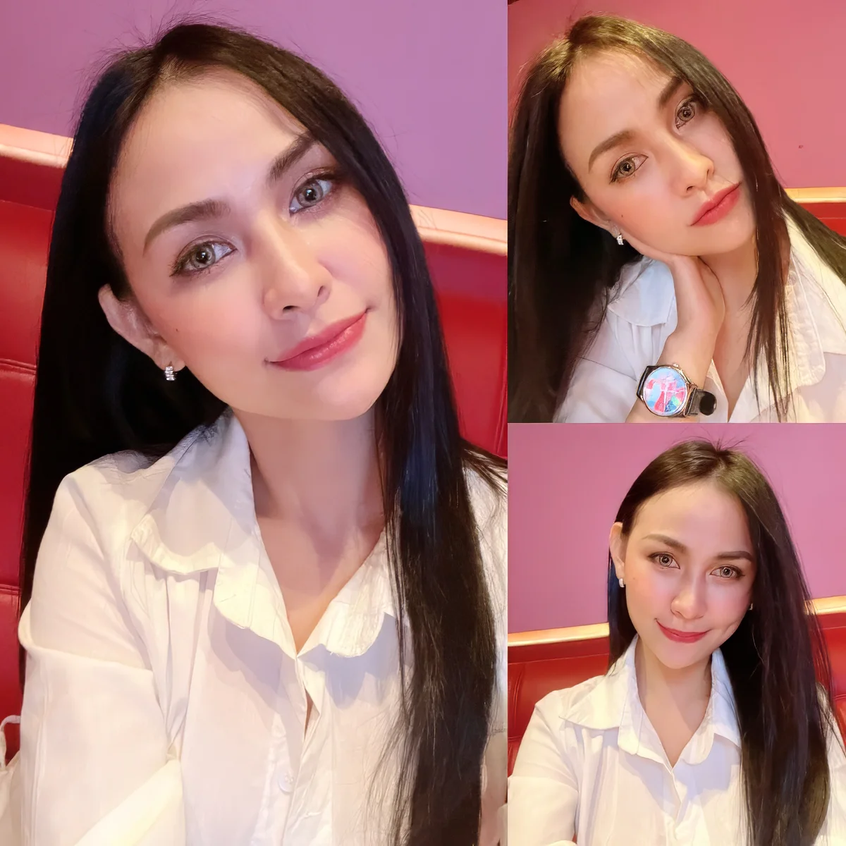 อายุ 30+ แต่หน้าเด็กลง 5 ปี แค่เติมฟิลเลอร์ใต้ตา