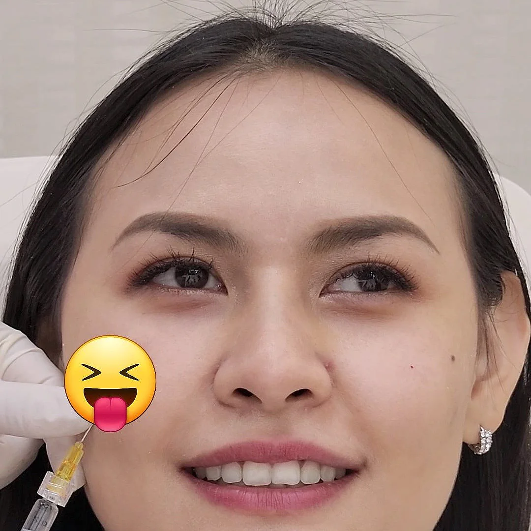 หน้าดูเหนื่อยตลอดเวลา ทั้งที่นอนเต็มอิ่ม อาจเป็นเพราะใต้ตาของคุณ