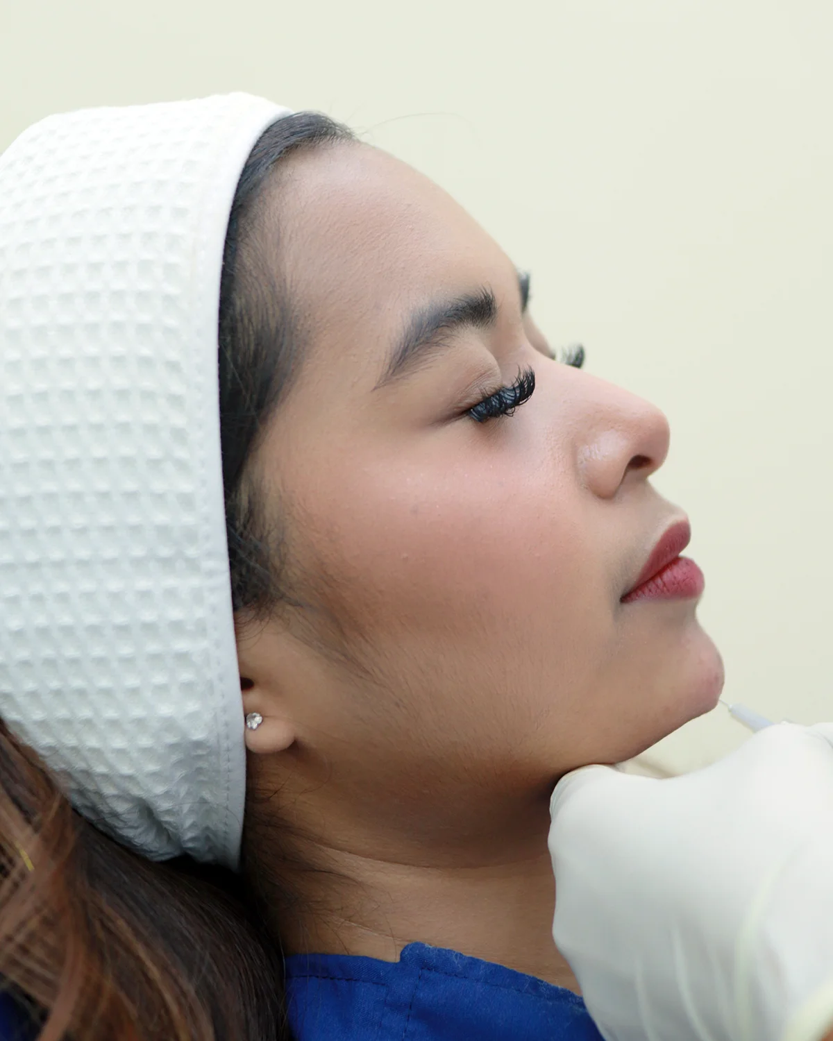 รีวิวเติมคาง ย่านเลียบด่วนรามอินทรา CDC สวยเป๊ะราคาเอื้อมถึง 8,999 บาท